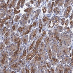 RAB3IP Antibody, Novus Biologicals 0.1mL; Unlabeled:Antibodies, Polyclonal