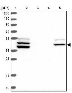 RAB3IP Antibody, Novus Biologicals 0.1mL; Unlabeled:Antibodies, Polyclonal