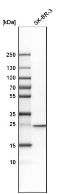 RAB5C Antibody, Novus Biologicals 0.1mL; Unlabeled:Antibodies, Polyclonal