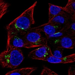 RAB6A Antibody, Novus Biologicals 0.1mL; Unlabeled:Antibodies, Polyclonal