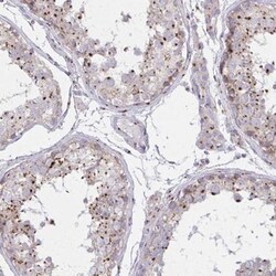 RAB6A Antibody, Novus Biologicals 0.1mL; Unlabeled:Antibodies, Polyclonal
