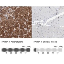 RAB9A Antibody, Novus Biologicals 25 &mu;L | Buy Online | Novus Biologicals | Fisher Scientific