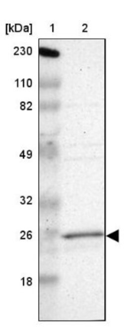 RAB9A Antibody, Novus Biologicals 25 &mu;L | Buy Online | Novus Biologicals | Fisher Scientific