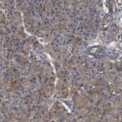 RABEP1 Antibody, Novus Biologicals 25 &mu;L; Unlabeled:Antibodies, Polyclonal