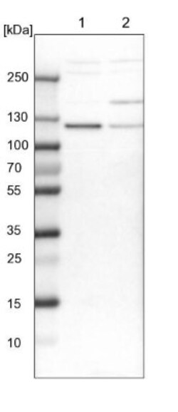 RABEP1 Antibody, Novus Biologicals 25 &mu;L; Unlabeled:Antibodies, Polyclonal