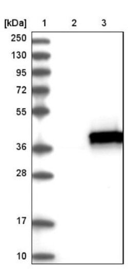RABGGTB Antibody, Novus Biologicals 25 &mu;L | Buy Online | Novus Biologicals | Fisher Scientific