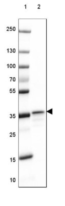 RABGGTB Antibody, Novus Biologicals 25 &mu;L | Buy Online | Novus Biologicals | Fisher Scientific