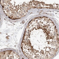 RABIF/MSS4 Antibody, Novus Biologicals 25 &mu;L; Unlabeled:Antibodies,