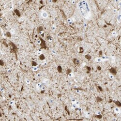 RABL4 Antibody, Novus Biologicals 25 &mu;L; Unlabeled:Antibodies, Polyclonal