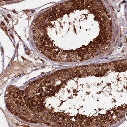 RABL5 Antibody, Novus Biologicals 0.1mL; Unlabeled:Antibodies, Polyclonal