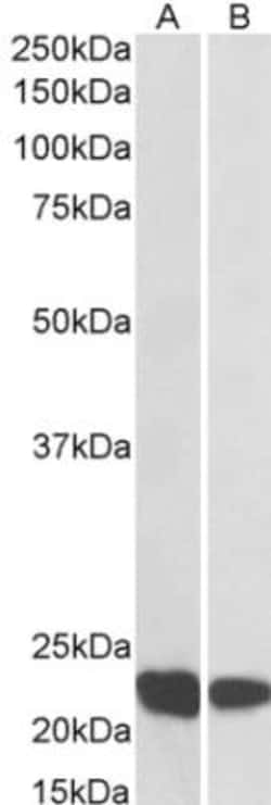 RAC2 Antibody, Novus Biologicals 0.1mg; Unlabeled:Anticuerpos