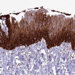 RAC3 Antibody, Novus Biologicals:Antibodies:Primary Antibodies