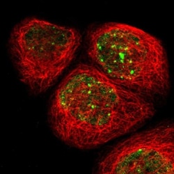 RAD18 Antibody, Novus Biologicals 0.1mL; Unlabeled:Antibodies, Polyclonal