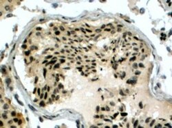 RAD51AP1 Antibody, Novus Biologicals 0.1mg; Unlabeled:Antibodies, Polyclonal