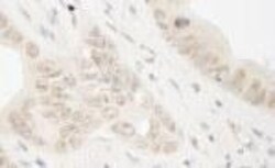 RAD54L2 Antibody, Novus Biologicals 0.1 mL | Buy Online | Novus Biologicals | Fisher Scientific