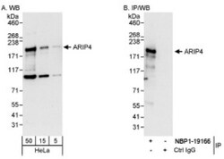 RAD54L2 Antibody, Novus Biologicals 0.1 mL | Buy Online | Novus Biologicals | Fisher Scientific