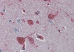 RAE1 Antibody, Novus Biologicals 0.1mg; Unlabeled:Antibodies, Polyclonal