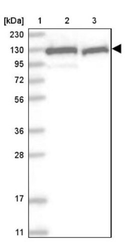 RAI14 Antibody, Novus Biologicals 0.1mL; Unlabeled:Antibodies, Polyclonal