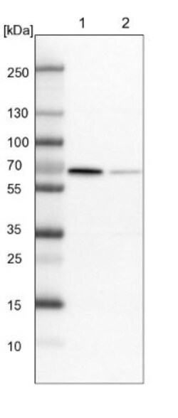 RAI16 Antibody, Novus Biologicals 25 &mu;L, Unconjugated:Antibodies, Polyclonal