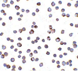 RAIDD/CRADD Antibody, Novus Biologicals 0.1mg; Unlabeled:Antibodies, Polyclonal