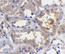RAIDD/CRADD Antibody, Novus Biologicals 0.1mg; Unlabeled:Antibodies, Polyclonal