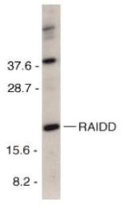 RAIDD/CRADD Antibody, Novus Biologicals 0.1mg; Unlabeled:Antibodies, Polyclonal