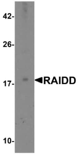 RAIDD/CRADD Antibody, Novus Biologicals 0.1mg; Unlabeled:Antibodies, Polyclonal