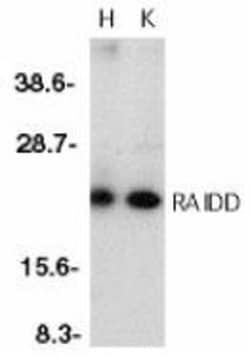 RAIDD/CRADD Antibody, Novus Biologicals 0.025 mg, Unconjugated:Antibodies,