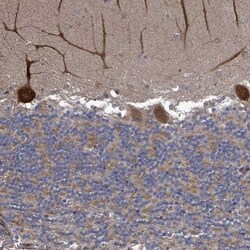 RALGAPB Antibody, Novus Biologicals:Antibodies:Primary Antibodies