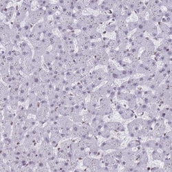 RALY Antibody, Novus Biologicals 25 &mu;L, Unlabeled:Antibodies, Polyclonal