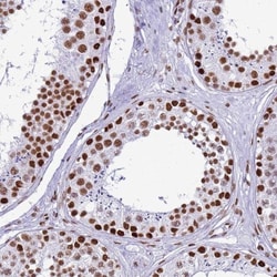 RALY Antibody, Novus Biologicals 25 &mu;L, Unlabeled:Antibodies, Polyclonal