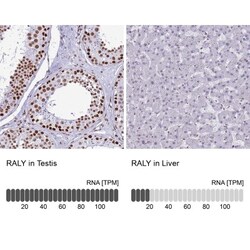 RALY Antibody, Novus Biologicals 25 &mu;L, Unlabeled:Antibodies, Polyclonal