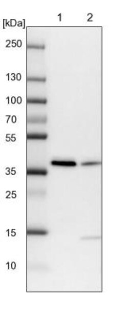 RALY Antibody, Novus Biologicals 25 &mu;L, Unlabeled:Antibodies, Polyclonal