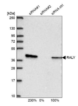 RALY Antibody, Novus Biologicals 25 &mu;L, Unlabeled:Antibodies, Polyclonal
