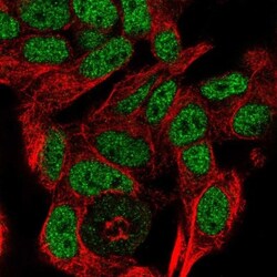 RALYL Antibody, Novus Biologicals 25 &mu;L, Unlabeled:Antibodies, Polyclonal