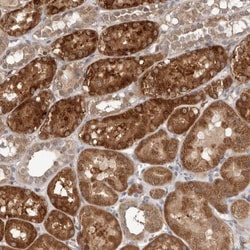 RANBP17 Antibody, Novus Biologicals 25 &mu;L; Unlabeled:Antibodies, Polyclonal