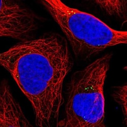 DBC1 Antibody, Novus Biologicals:Antibodies:Primary Antibodies