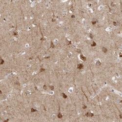 RANK/TNFRSF11A Antibody, Novus Biologicals 0.1mL; Unlabeled:Antibodies,