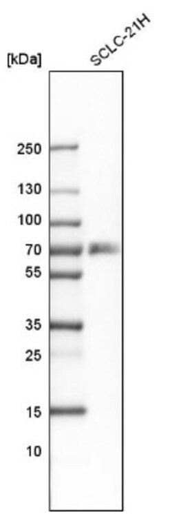 RANK/TNFRSF11A Antibody, Novus Biologicals 0.1mL; Unlabeled:Antibodies,