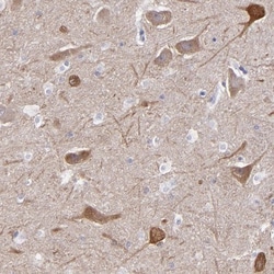 RAP1GAP Antibody, Novus Biologicals 25 &mu;L; Unlabeled:Antibodies, Polyclonal