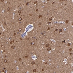 RAP1GAP Antibody, Novus Biologicals 25 &mu;L; Unlabeled:Antibodies, Polyclonal