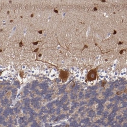 RAP1GAP Antibody, Novus Biologicals 25 &mu;L; Unlabeled:Antibodies, Polyclonal