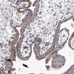 RAP6 Antibody, Novus Biologicals:Antibodies:Primary Antibodies