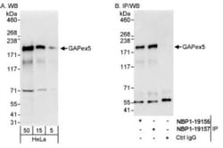 RAP6 Antibody, Novus Biologicals 0.1 mL | Buy Online | Novus Biologicals | Fisher Scientific