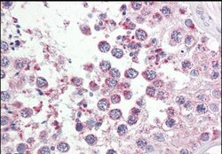 RAP80 Antibody, Novus Biologicals 0.1mg; Unlabeled:Antibodies, Polyclonal