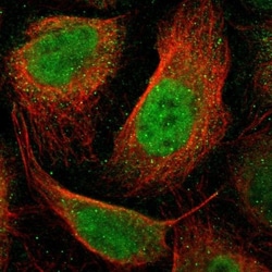 anti-RAR beta/NR1B2, Polyclonal, Novus Biologicals 0.1mL; Unlabeled:Antibodies,