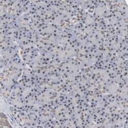 anti-RAR beta/NR1B2, Polyclonal, Novus Biologicals 0.1mL; Unlabeled:Antibodies,
