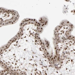anti-RAR beta/NR1B2, Polyclonal, Novus Biologicals 0.1mL; Unlabeled:Antibodies,