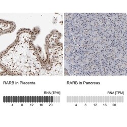 anti-RAR beta/NR1B2, Polyclonal, Novus Biologicals 0.1mL; Unlabeled:Antibodies,