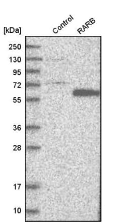 anti-RAR beta/NR1B2, Polyclonal, Novus Biologicals 0.1mL; Unlabeled:Antibodies,